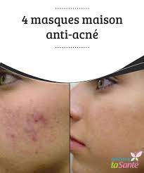 masque anti acné maison