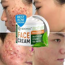 crème anti acné